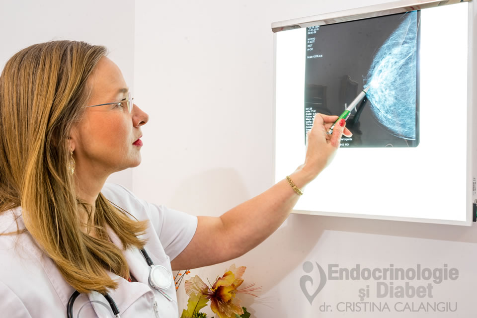 P17-Elastografia mamara- cabinet medical Endocrinologie Diabet Craiova